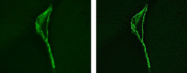 图片：成体小鼠室管膜细胞的染色放大图像……